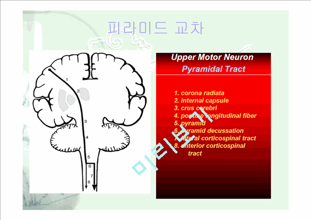 [의학]신경계case - 뇌간손상[Brain stem lesion]에 관해   (9 )